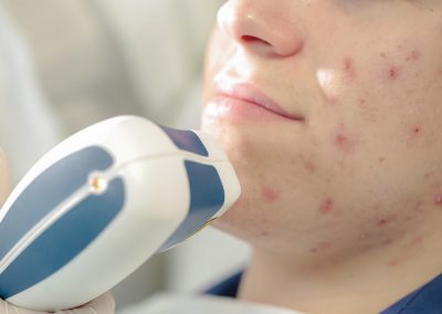 Lazerinė dermatologija Vilniuje