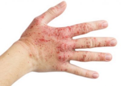 Odos ligų diagnostika ir gydymas Vilniuje