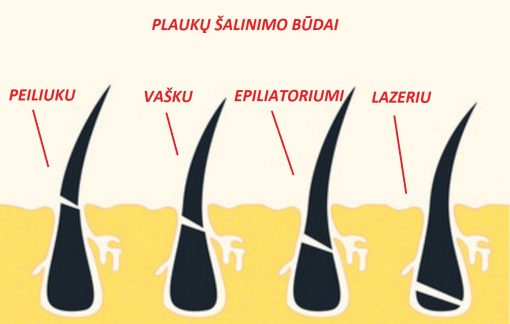Ilgalaikis plaukelių &scaron;alinimas