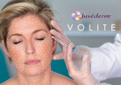 Estetinė dermatologija