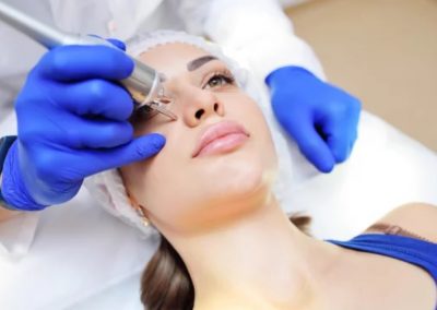 Lazerinė dermatologija Vilniuje