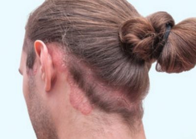 Odos ligų diagnostika ir gydymas Vilniuje