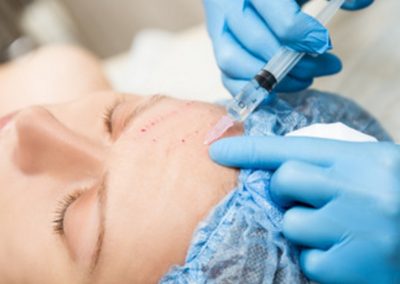 Estetinė dermatologija