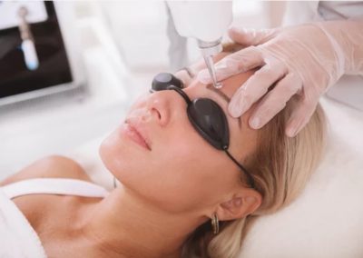 Lazerinė dermatologija Vilniuje