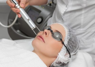 Frakcinis odos atjauninimas lazeriu