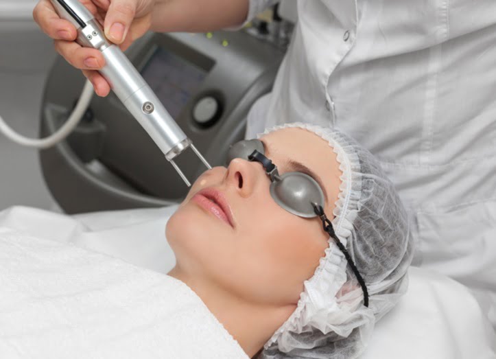 Frakcinis odos atjauninimas lazeriu