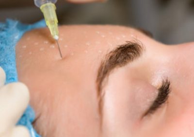 Estetinė dermatologija