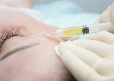 Estetinė dermatologija