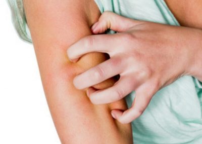 Odos ligų diagnostika ir gydymas Vilniuje