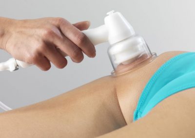 Kosmetologinės procedūros Vilniuje